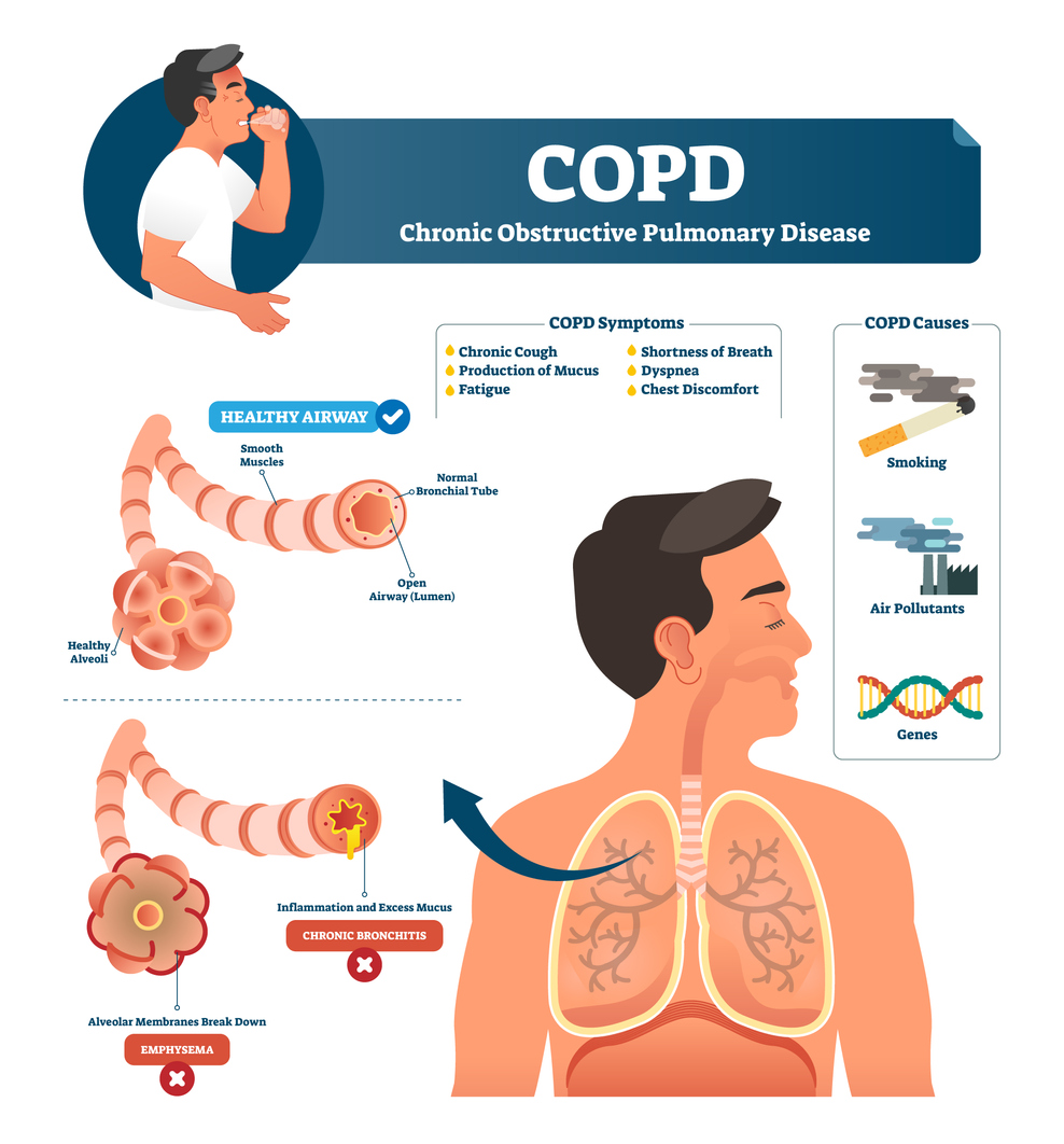 COPD Awareness Month